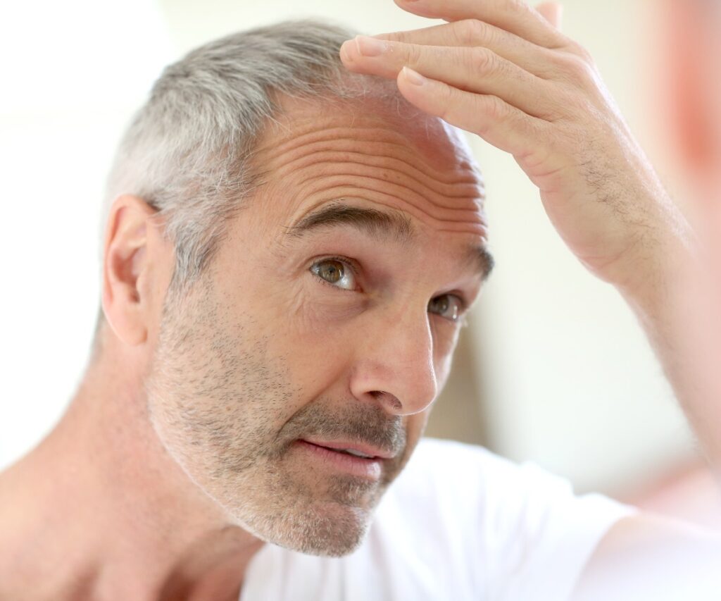 Senior man and hair loss issue jpg
