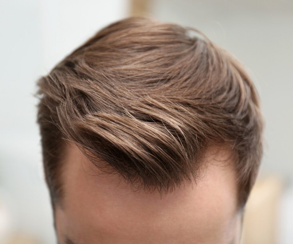 Young man with hair loss problem indoors closeup jpg